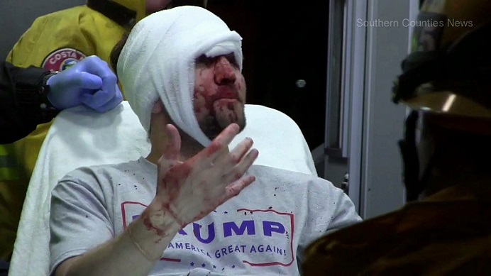 bloodied-trump-supporter